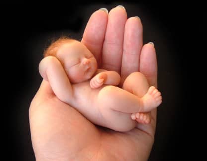 Slider image (3) Kamla Devi Healthcare Private Limited - IVF in Lucknow, India
